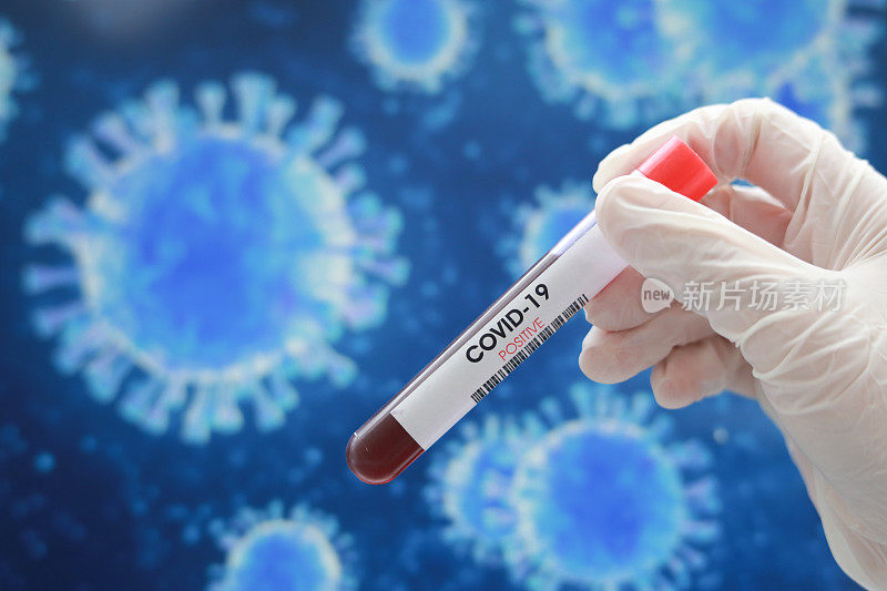 冠状病毒的血液测试。冠状病毒实验室血液呈阳性。背景中的冠状病毒图像