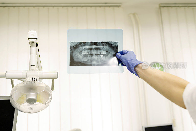 牙科医生正在牙科诊所分析x光影像