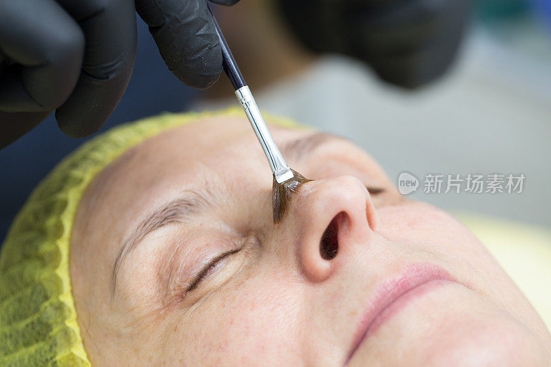美容师将一种透明的化学溶液用于女性面部脱皮。