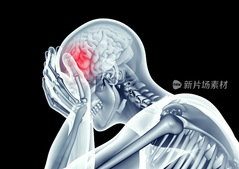 人类头部疼痛的x光图像
