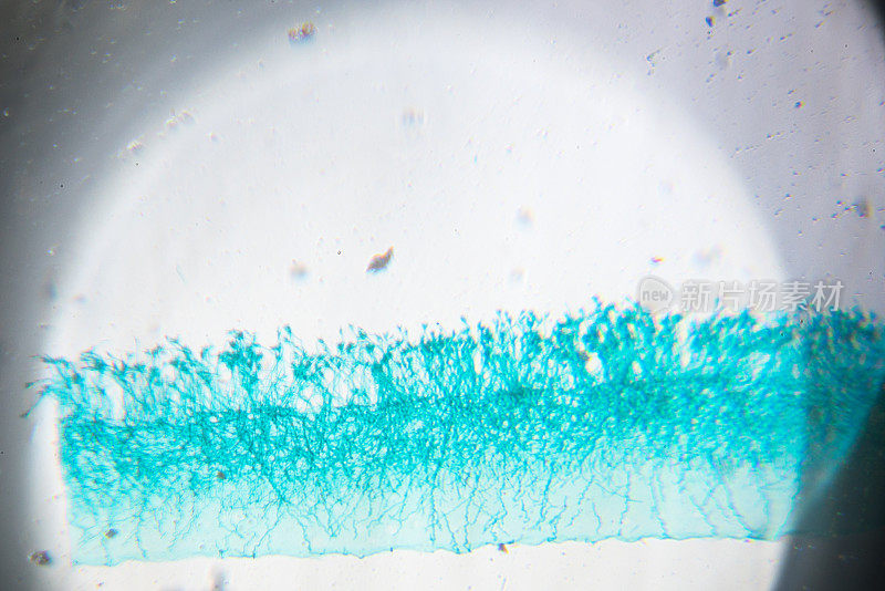 青霉菌在显微镜