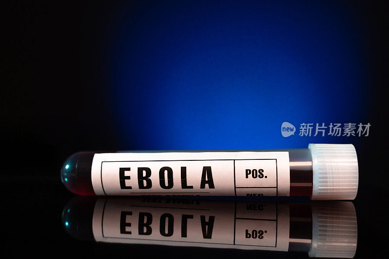 埃博拉病毒血样检测试管特写白标，蓝色背景
