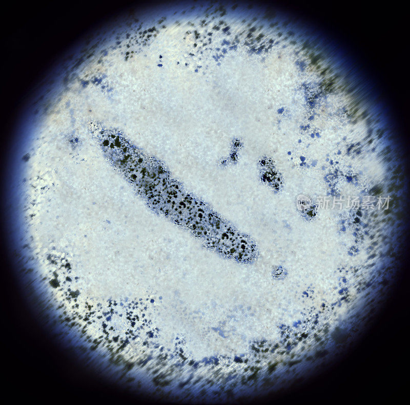 显微镜下的新喀里多尼亚形状的细菌(系列)