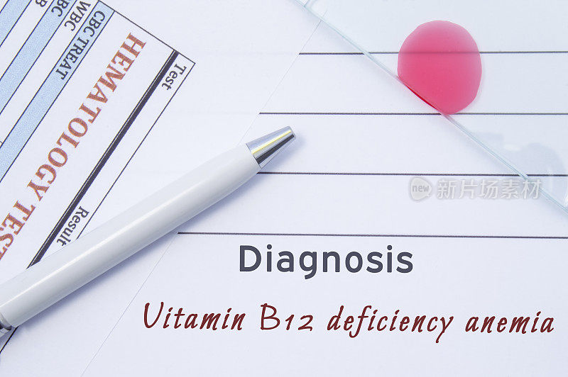 诊断维生素B12缺乏性贫血。由医生血液学诊断的维生素B12缺乏性贫血的医学报告，这是血液检查和血液涂片玻片的结果
