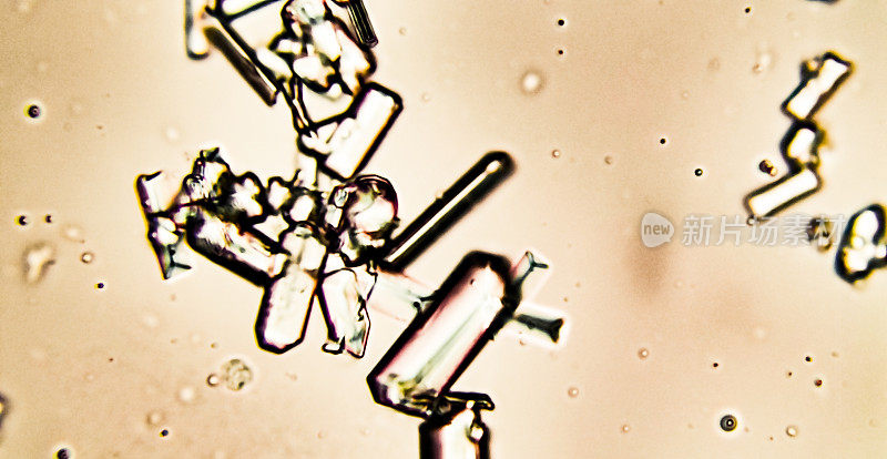 尿液沉积物中草酸钙和马尿酸结晶的显微镜观察