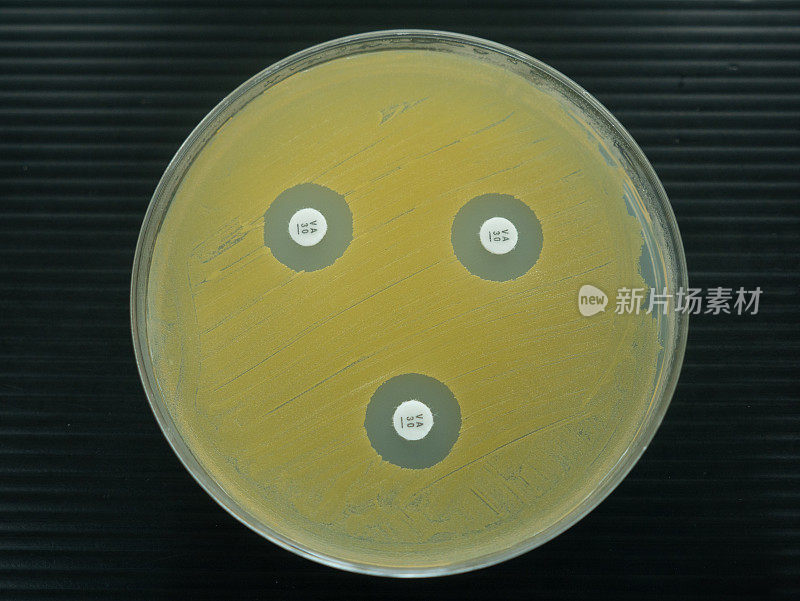 在实验室检查抗生素的培养皿的特写镜头。