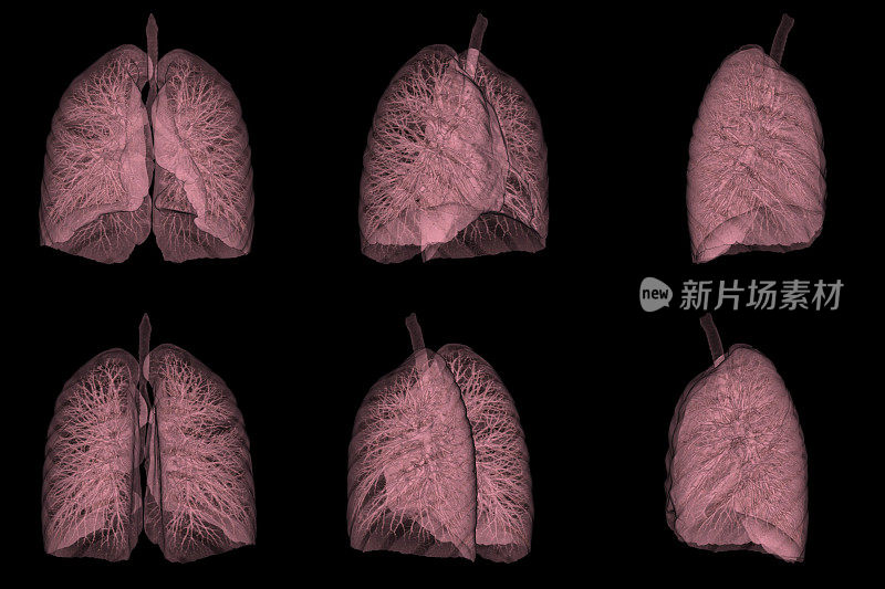 人肺三维CT扫描图像