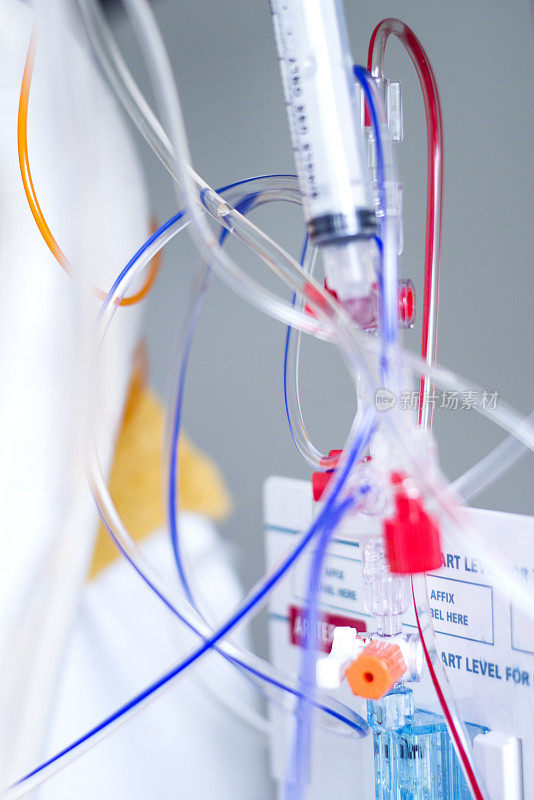 ICU静脉滴注及血流动力学监测系统