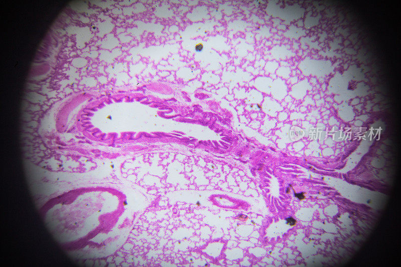显微镜下兔肺横切面