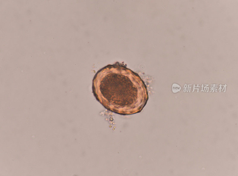 蛔虫虫卵大便检查。