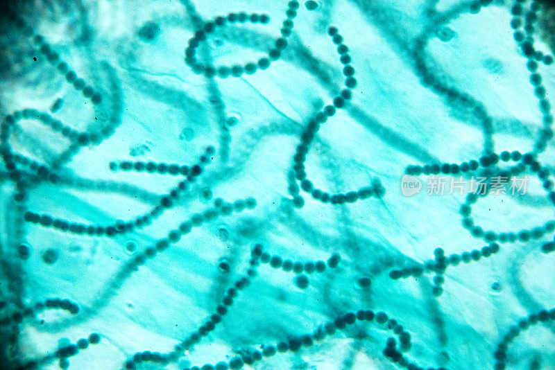 显微镜下的珠藻
