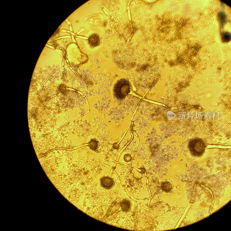 在显微镜下看到的烟曲霉。