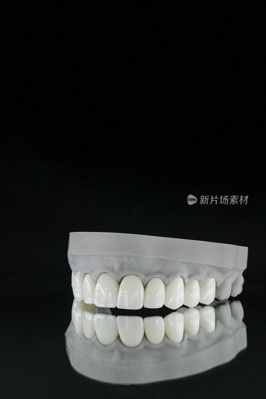 好莱坞设计的牙科模型精心准备的优质诊所