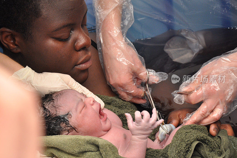 Baby-Day;脐带被剪断的水中分娩婴儿