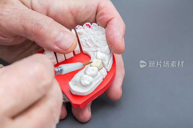 牙医用手拿着牙刷在做陶瓷牙科模型