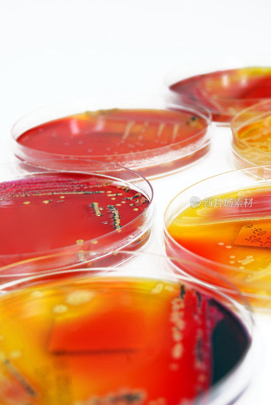 微生物学:彩色细菌培养物