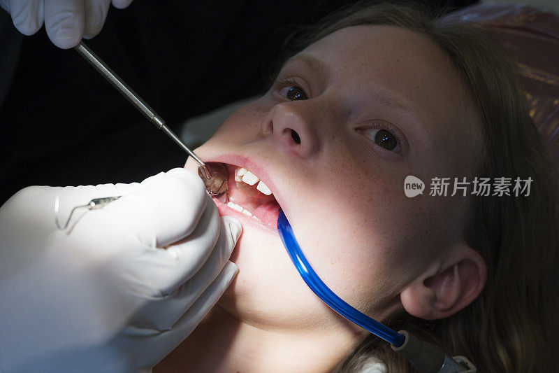 一个正在看牙医的女孩