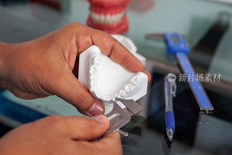 牙齿矫正专家牙医在他的办公室使用牙齿模型向他的病人解释治疗