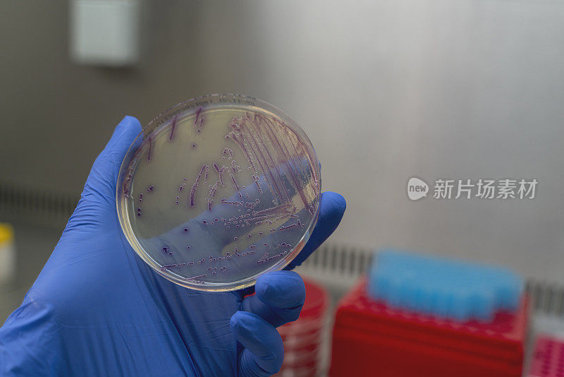 生产培养物的实验室技术员在医院微生物科工作。