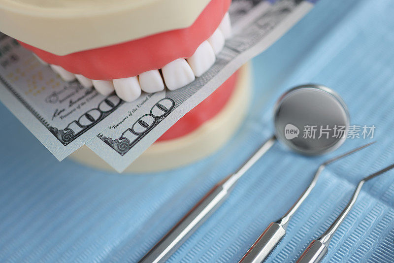 戴假牙的假牙。牙科医疗器械
