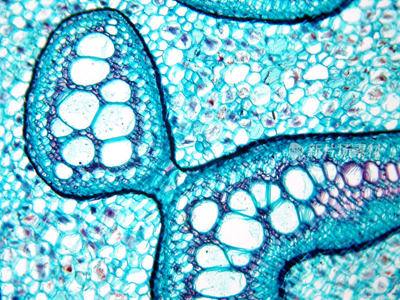 植物组织在显微镜下，蕨茎