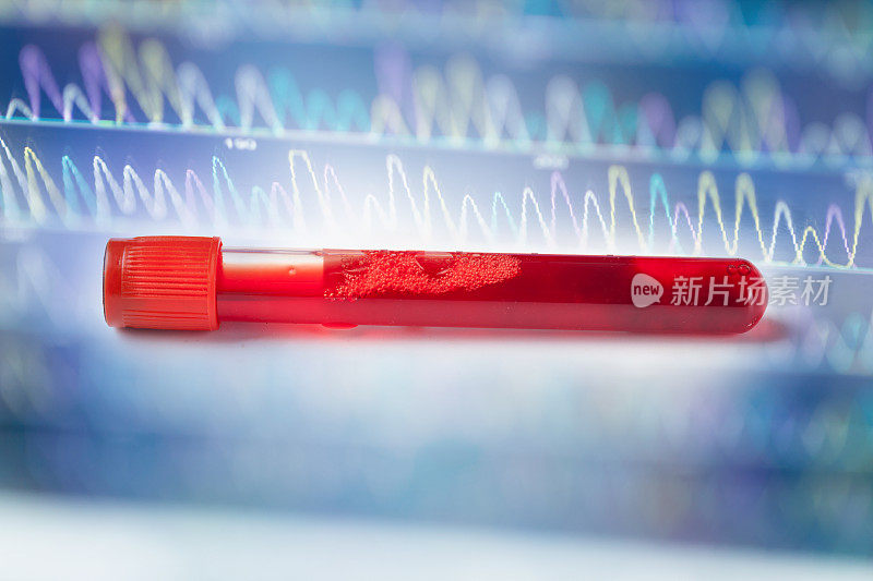 试管中的血液样本，背景为DNA序列