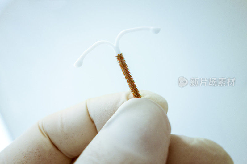 宫内节育器(IUD)