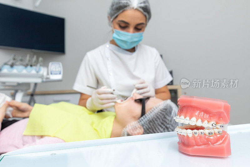 正畸模型和牙医工具。各种正畸托架或牙套的牙齿模型