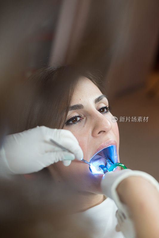 牙科治疗紫外线光设备