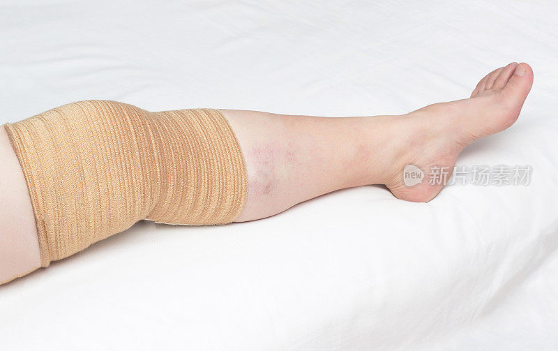 医疗膝盖骨修复酸痛膝盖从骨关节炎和其他疾病，特写，拷贝空间