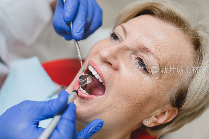在口腔检查时张开嘴。牙科矫正口腔医生治疗手术填补牙齿牙齿口腔的女性病人。