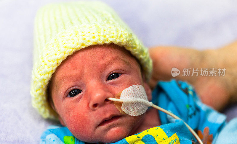 早产儿在新生儿重症监护室，眼睛睁着。