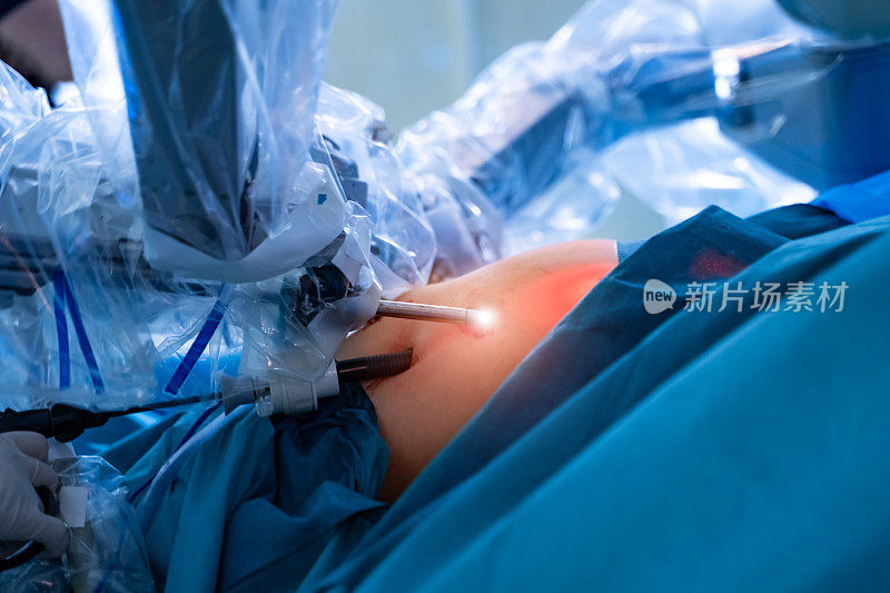 医院的手术室里有机器人技术设备，机器手臂外科医生在未来的手术室里