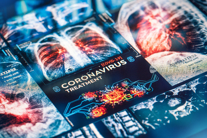 COVID-19冠状病毒治疗