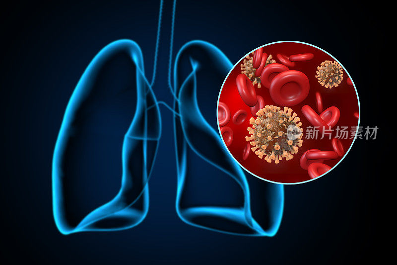 冠状病毒对肺部