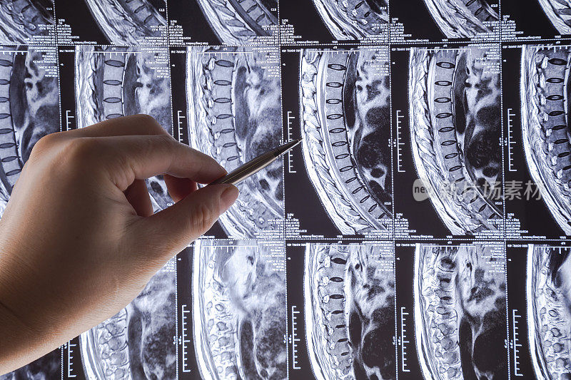 用医生的手对人体腰椎进行MRI扫描