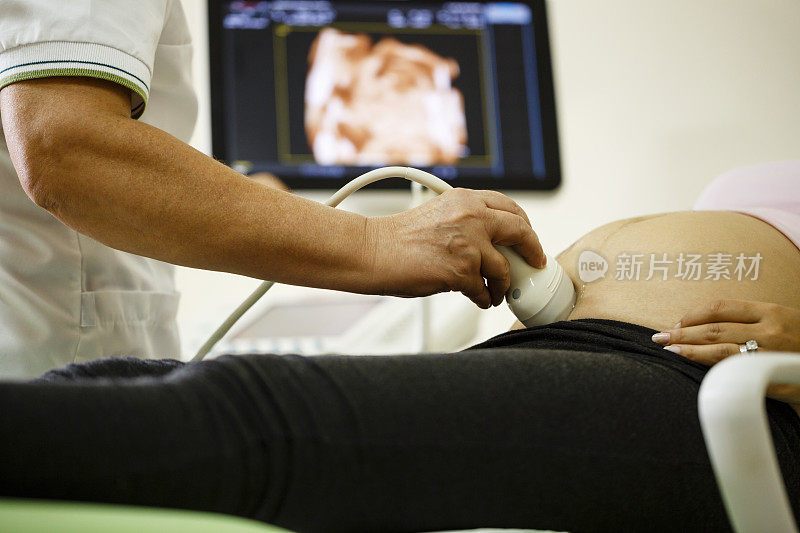 医生给孕妇做超声波检查