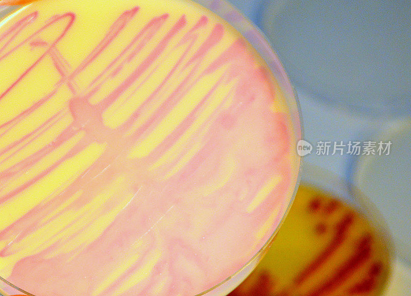 抗生素耐药性超级细菌