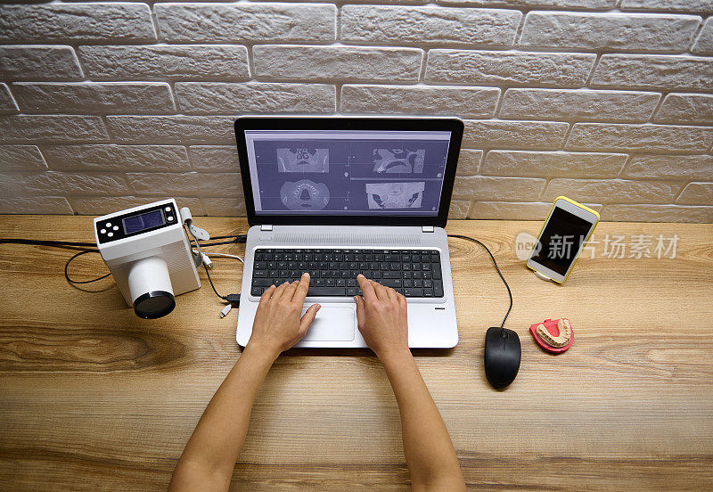 俯视图的医生放射科医生牙医手在笔记本电脑键盘上打字与全景牙科x光，而坐在桌子与当代专业便携式x光机和手机