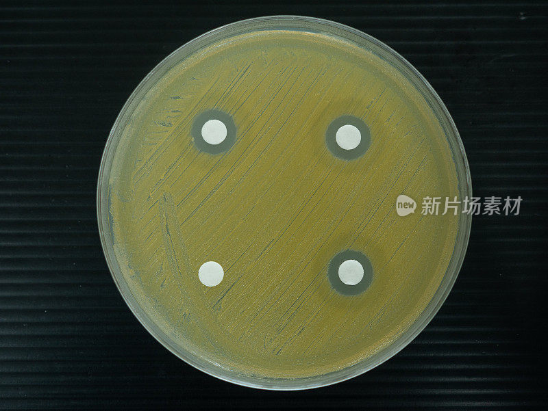在实验室检查抗生素的培养皿的特写镜头。