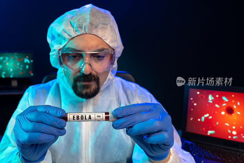 实验室科学家在实验室里查看埃博拉病毒的血液样本