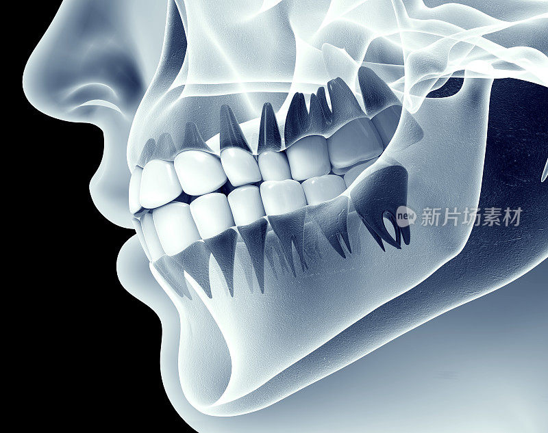 带有牙齿的颌的x光图像