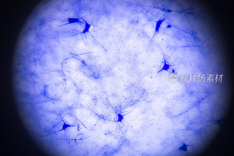 显微镜下的运动神经细胞