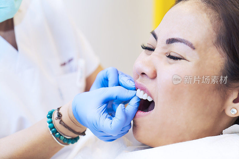 在牙科诊所进行例行牙科检查的妇女