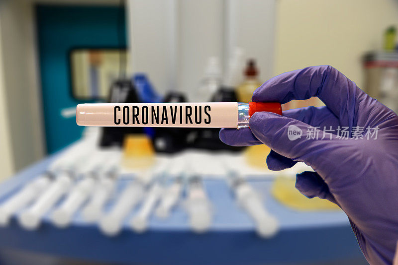 医生在医院拿着冠状病毒试管