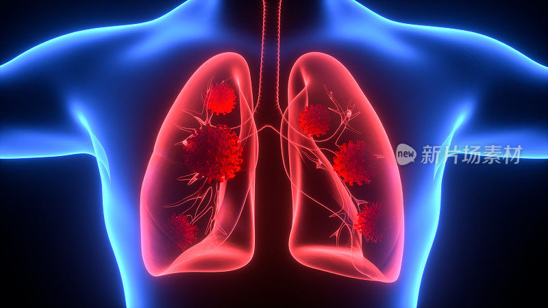 肺的3D插图，医学概念