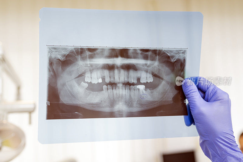 牙科医生正在牙科诊所分析x光影像