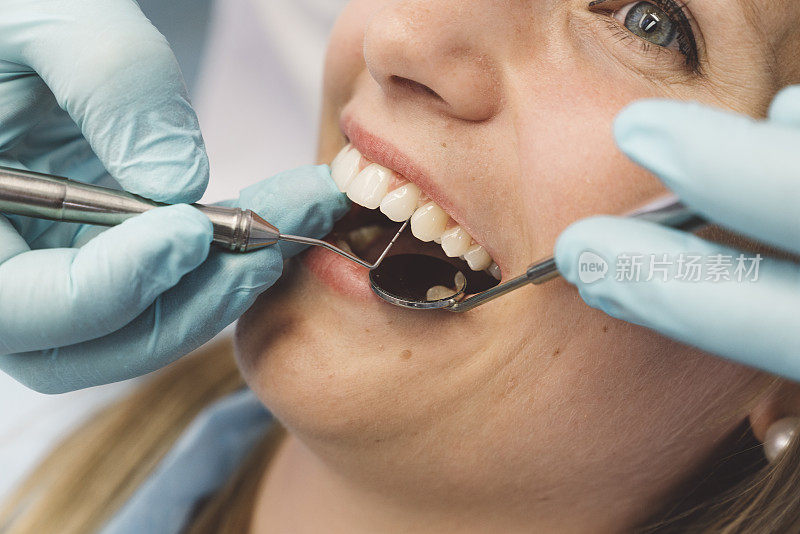 牙医检查
