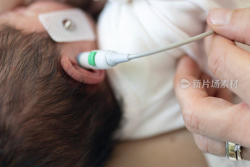 新生儿听力测试