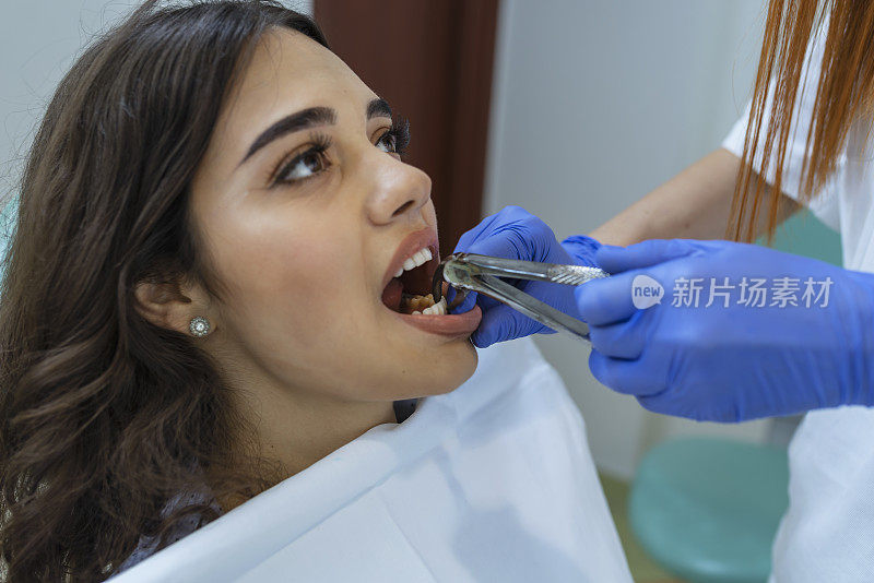 牙医正在给一个女人拔牙